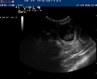 /album/fotogalerie-ultraschall/getattachment1-jpg/