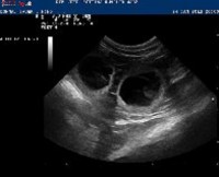 /album/fotogalerie-ultraschall/getattachment2-jpg/